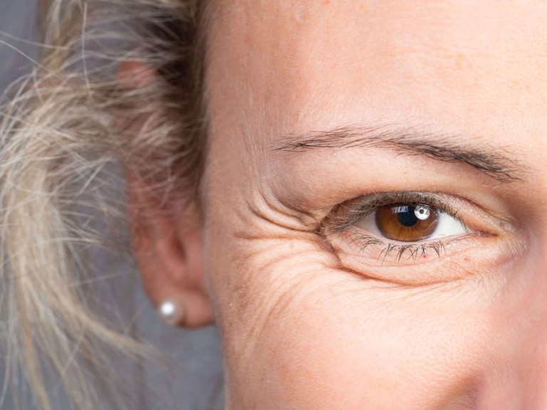 Các vấn đề lão hóa của vùng da dưới mắt